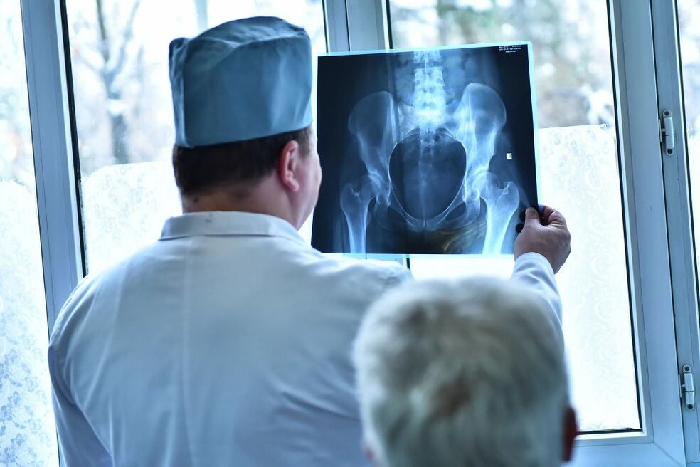 Dokter ningali gambar gabungan hip sareng arthrosis